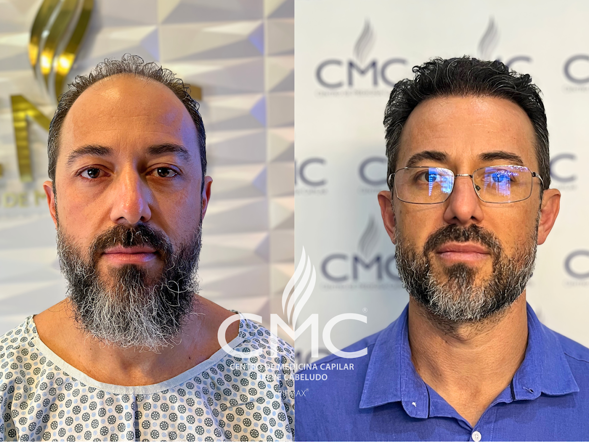 Foto da CMC