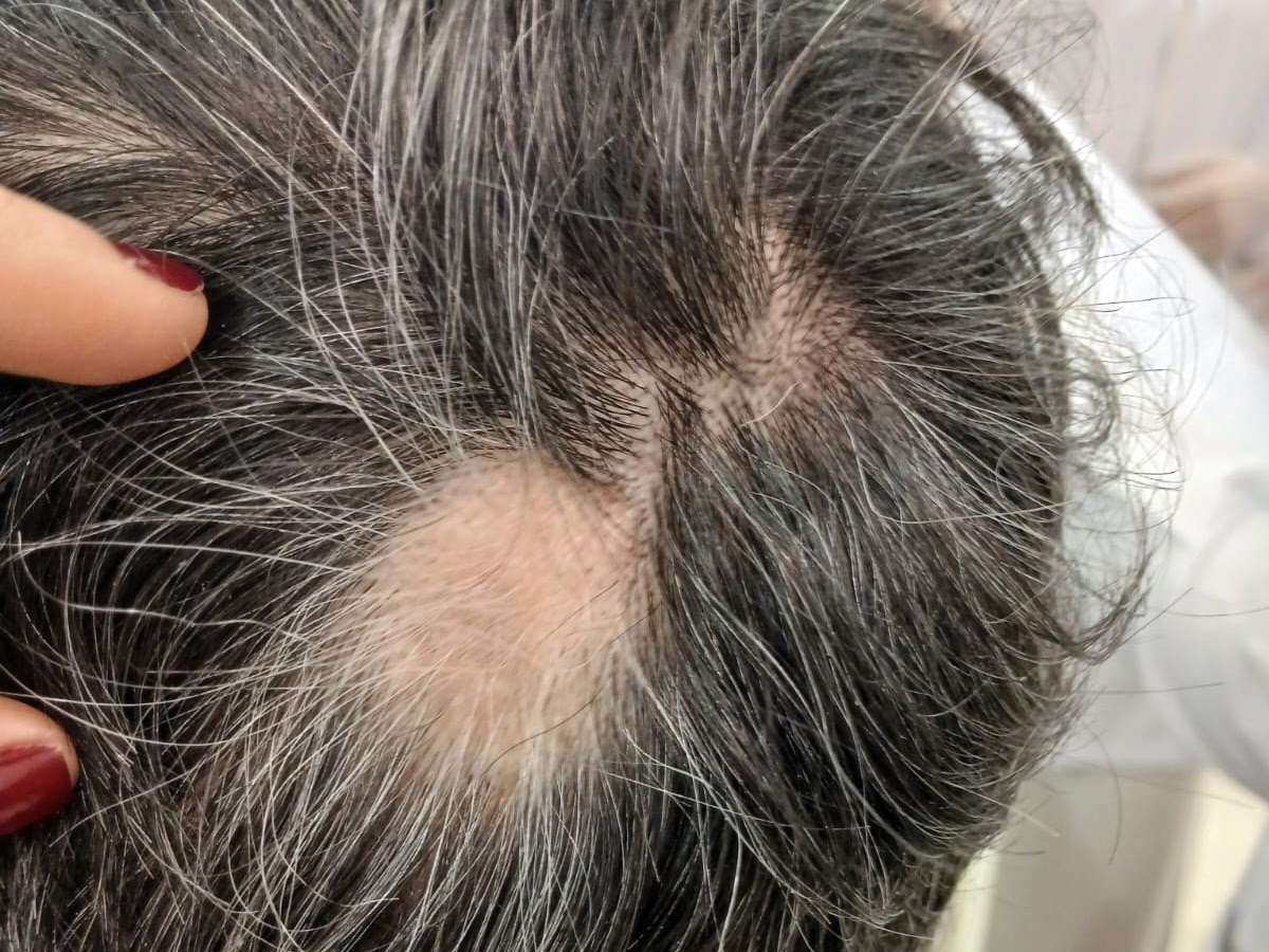 DNA Vital Complexo Capilar | Terapia Capilar em Florianópolis — foto 4