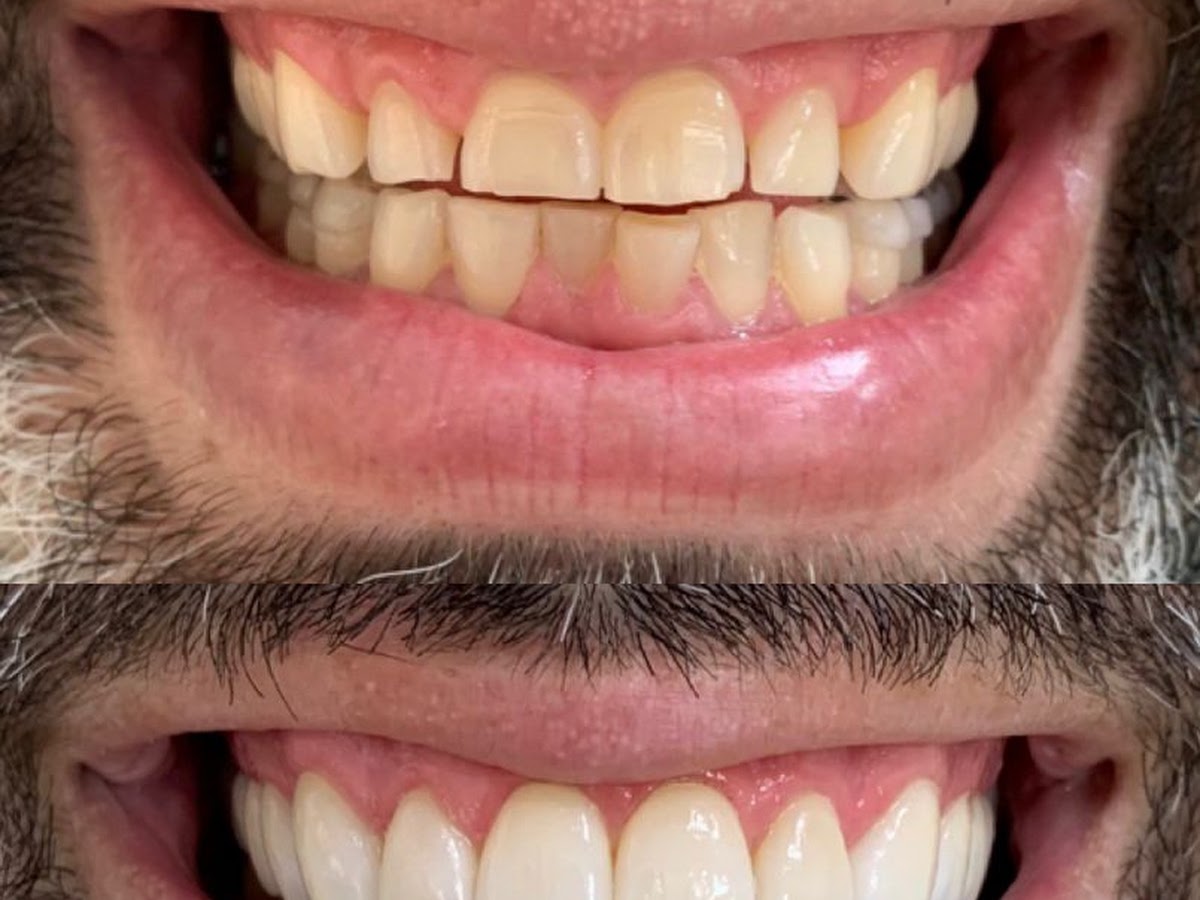 Foto da Dra Cátia Hackbarth - Dentista Santa Mônica