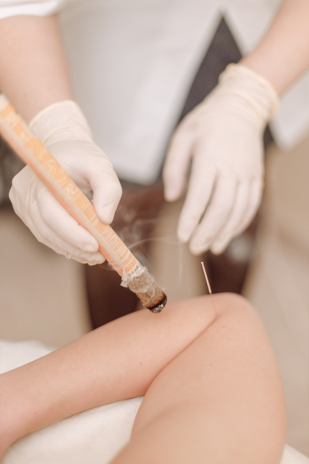 Rodolfo Bornia - Acupuntura - Quiropraxia - Dry Needling - Eletroacupuntura - Liberação Miofascial em Florianópolis — foto 4